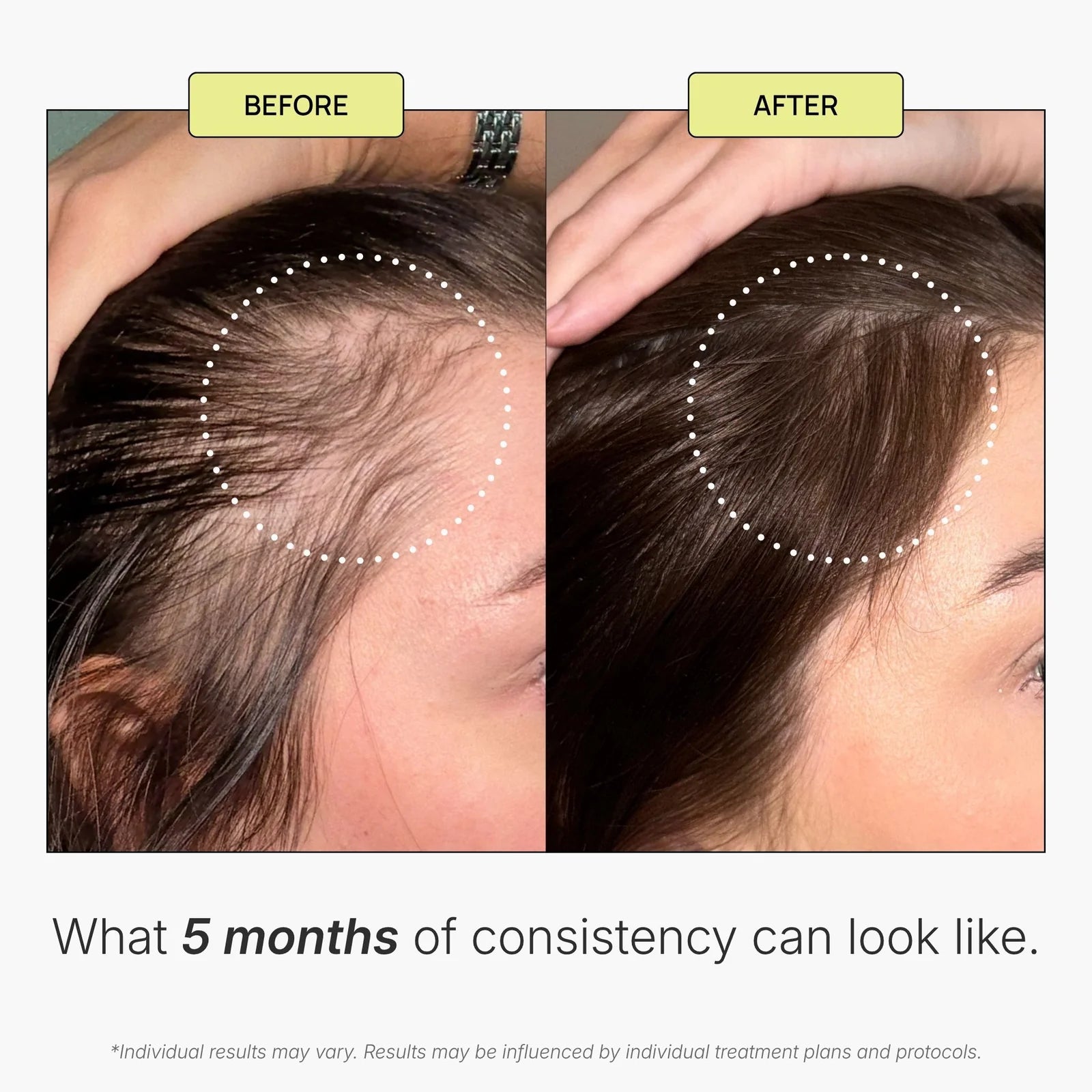 KeraFactor MD Scalp Stimulating Solution