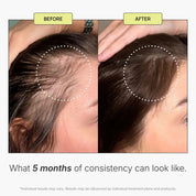 KeraFactor MD Scalp Stimulating Solution