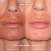 PAVISE Extracellular Matrix Restore
