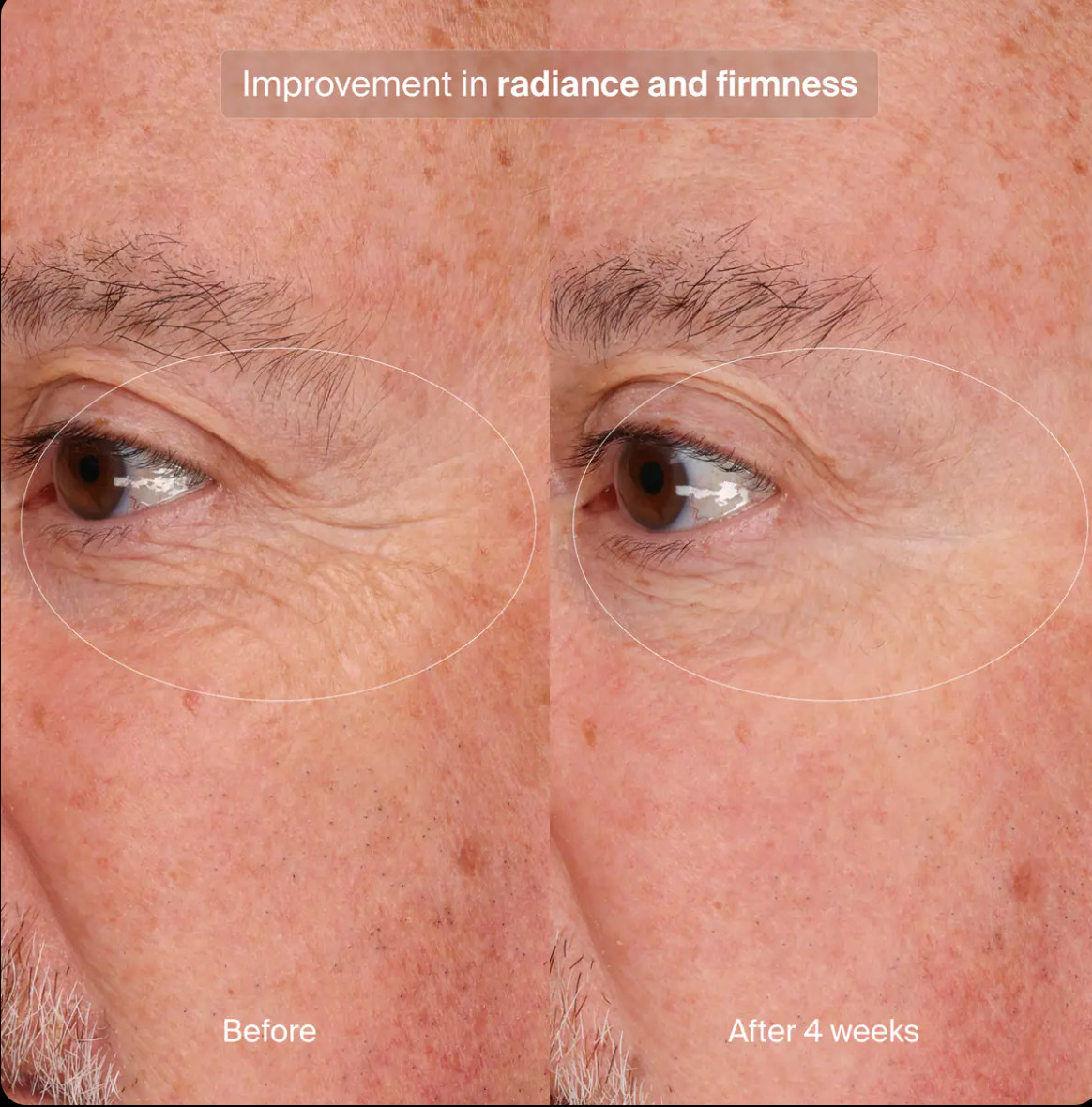 Pavise Precision Eye Lift
