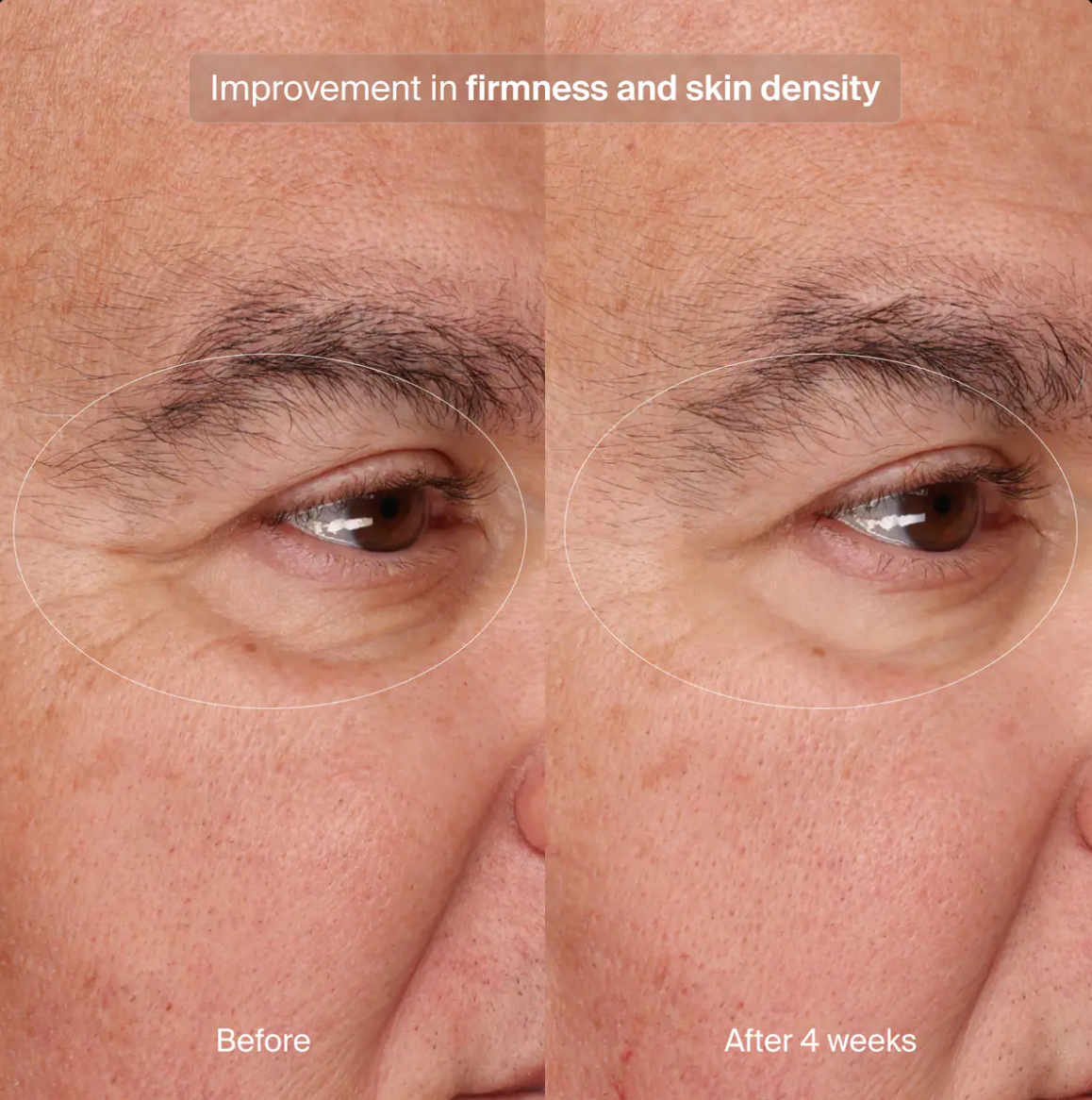 Pavise Precision Eye Lift