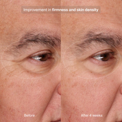 Pavise Precision Eye Lift