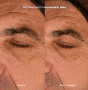 Pavise Precision Eye Lift