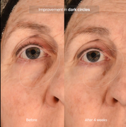 Pavise Precision Eye Lift