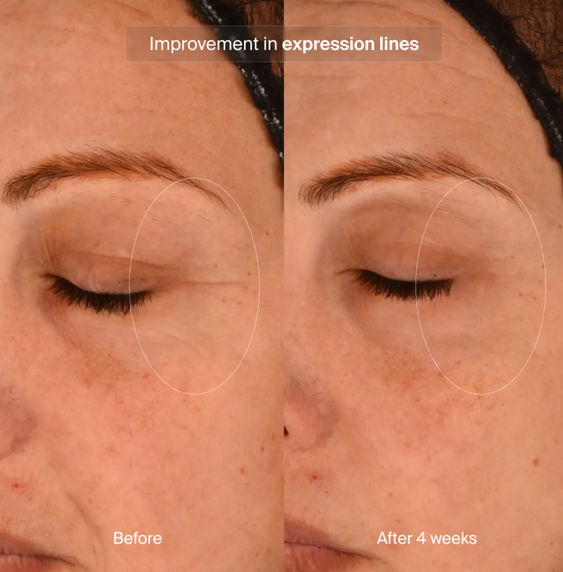 Pavise Precision Eye Lift