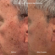 Pavise Dynamic Age Defense SPF 30