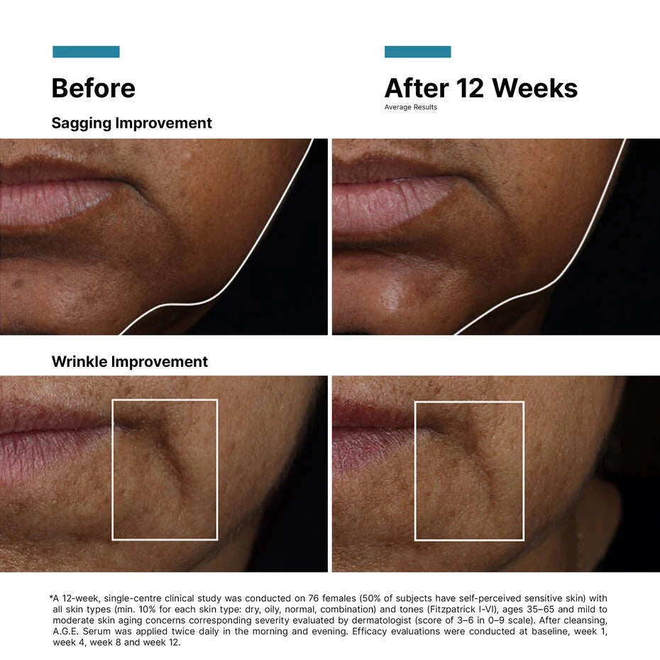 AGE Interrupter Ultra Serum