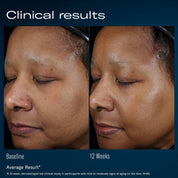 SkinBetter Ampra clinical results before and after 12 weeks