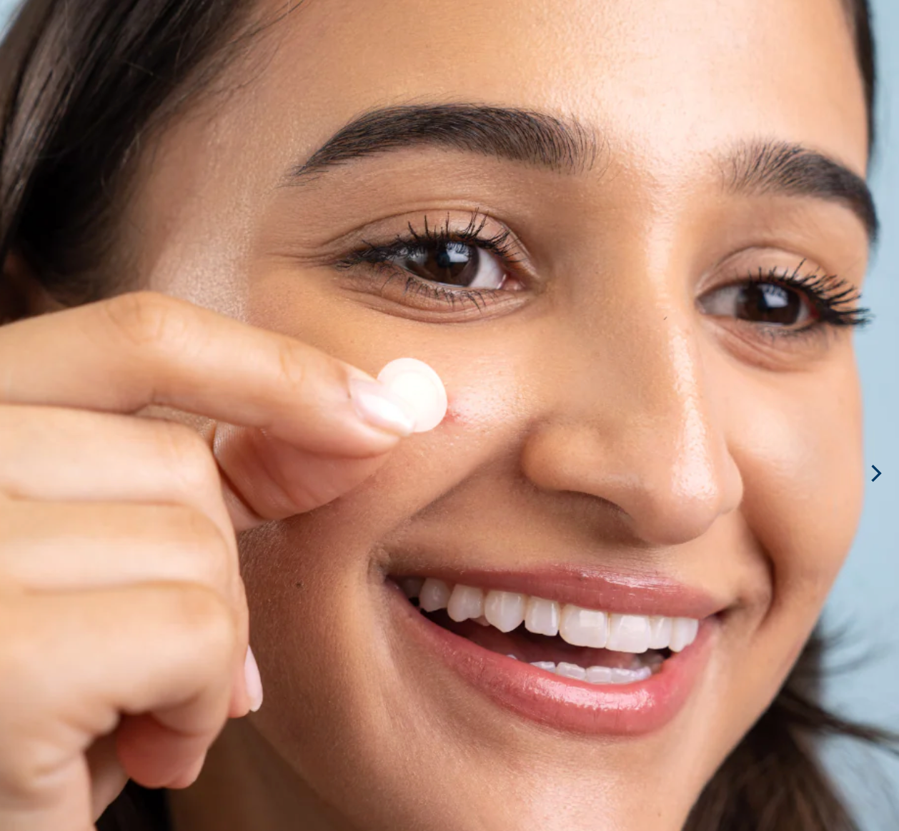 DermaDot Invisible Pimple Patches (60 Patches) - bespøke by SKINALCHEMY