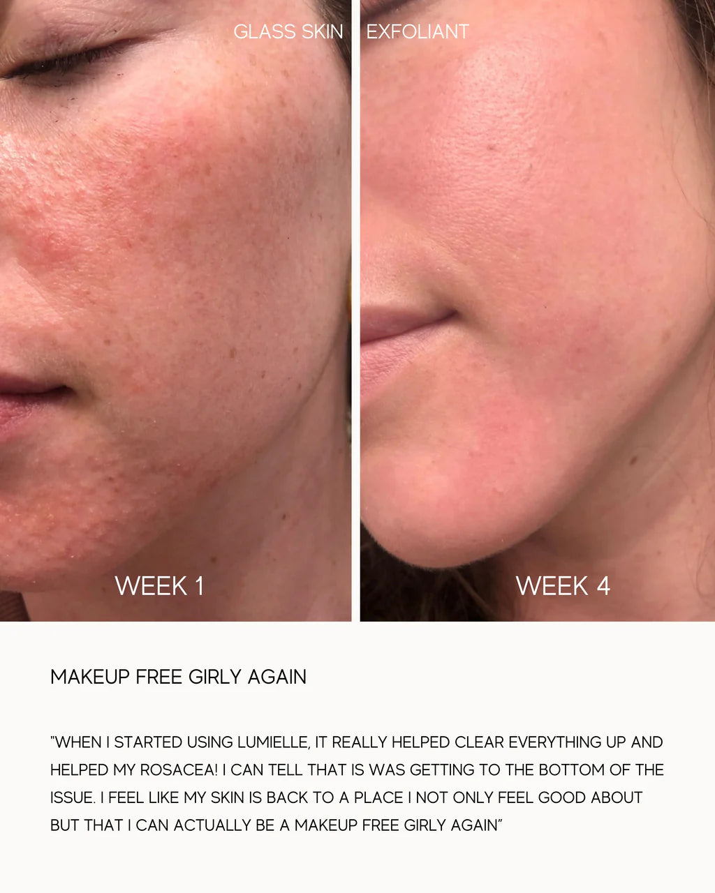 Glass Skin Liquid Exfoliant – Lumielle - bespøke by SKINALCHEMY