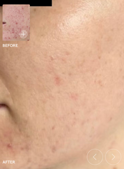 SIV Biome Balancing Serum - bespøke by SKINALCHEMY