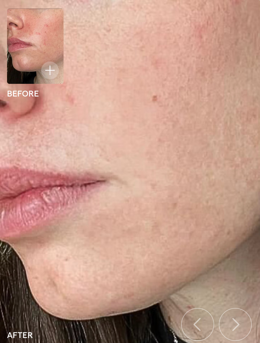 SIV Biome Balancing Serum - bespøke by SKINALCHEMY
