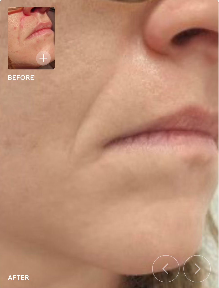 SIV Biome Balancing Serum - bespøke by SKINALCHEMY
